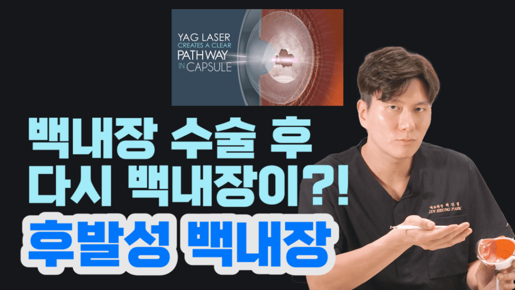 후발성 백내장, 백내장 수술 부작용, 안내염, 백내장 재발