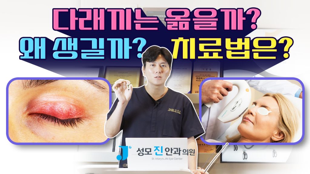 다래끼 궁금증, 다래끼 전염, 다래끼 안과, 다래끼