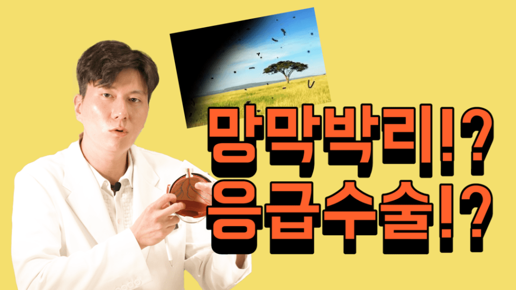 망막박리, 비문증 치료, 눈 빛번짐, 망막열공, 비문증 안과
