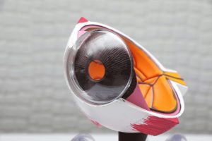 백내장 수술, 알콘렌즈, 백내장 증상, 백내장 수술비용