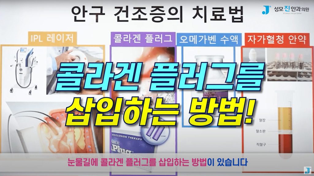 눈밑 떨림, 눈꺼풀 떨림, 눈떨림 원인, 눈위 떨림, 마그네슘 효능