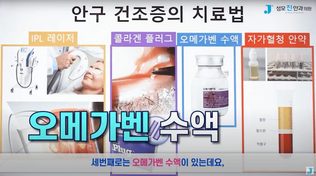 눈밑 떨림, 눈꺼풀 떨림, 눈떨림 원인, 눈위 떨림, 마그네슘 효능