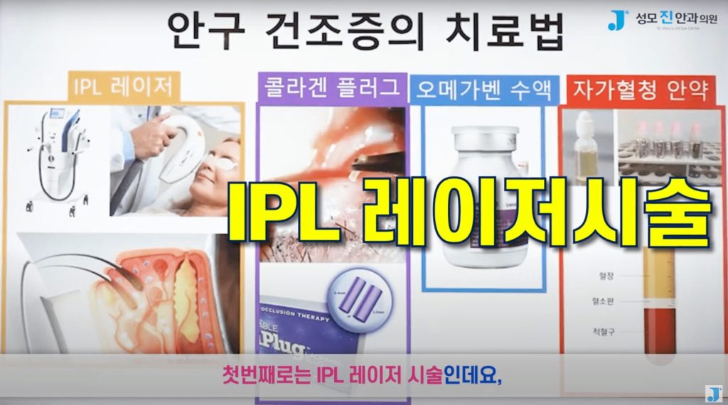 안구건조증 해결, 눈시림, 인공눈물 부작용, 일회용 인공눈물, 인공눈물 하루에 몇번