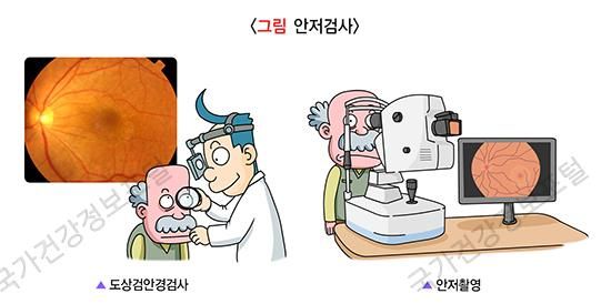 당뇨망막병증, 당뇨병 금기 음식, 당뇨병 합병증, 당뇨망막병증 초기 증상, 당뇨에 좋은 음식