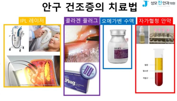 안구건조증 해결, 눈시림, 인공눈물 부작용, 일회용 인공눈물, 인공눈물 하루에 몇번