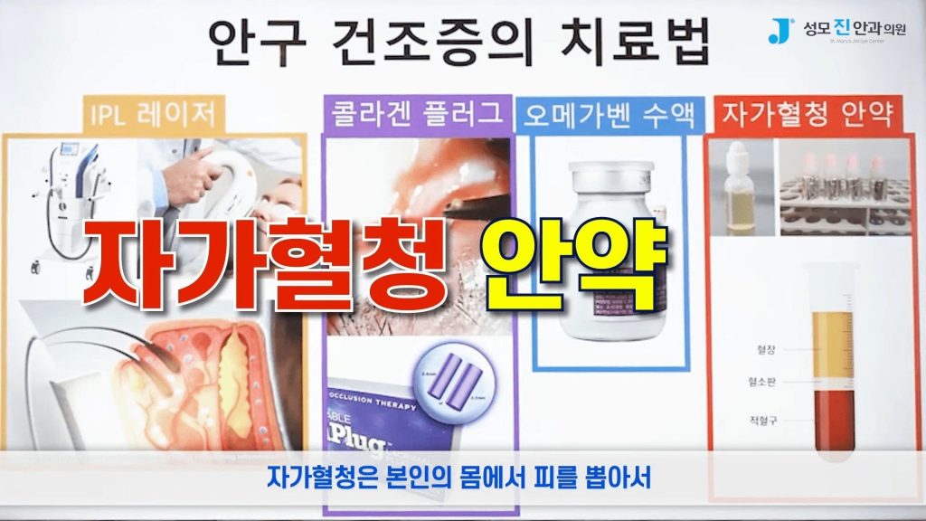 안구건조증 해결, 눈시림, 인공눈물 부작용, 일회용 인공눈물, 인공눈물 하루에 몇번