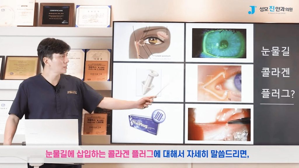 안구건조증 해결, 눈시림, 인공눈물 부작용, 일회용 인공눈물, 인공눈물 하루에 몇번