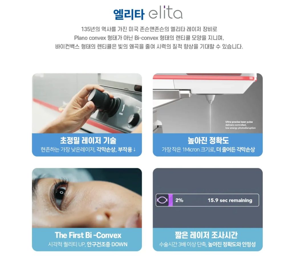 스마일라식 한쪽 눈 흐림, 스마일라식 눈 움직이면, 스마일라식 회복속도, 라식 라섹 스마일 차이, 근시퇴행