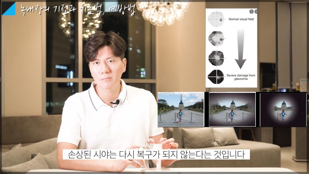 녹내장에 나쁜 음식, 녹내장 초기증상, 녹내장 치료법, 녹내장에 좋은 음식, 녹내장 완치 사례