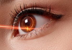 스마일라식 통증, 스마일라식 후 시력저하, 스마일라식 뿌연 증상, 스마일라식 후회, 엘리타