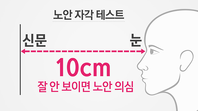 노안 테스트, 노안 개선 방법, 노안 영어로, 노안 뜻, 노안 나이