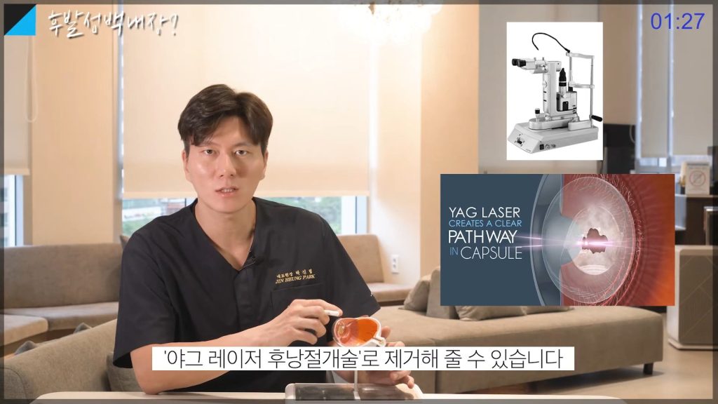 후발성 백내장, 빛 번짐, 눈 부심, 시야 흐림, 레이저 치료 효과