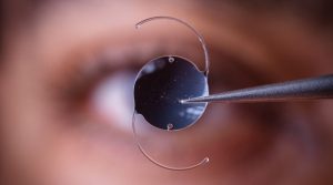 백내장 수술 비용, 백내장 검사 비용, 백내장 수술 시간, 백내장 수술 과정, 백내장 수술 잘하는 병원