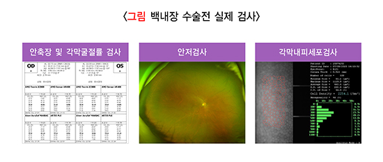 백내장 수술 비용, 백내장 검사 비용, 백내장 수술 시간, 백내장 수술 과정, 백내장 수술 잘하는 병원