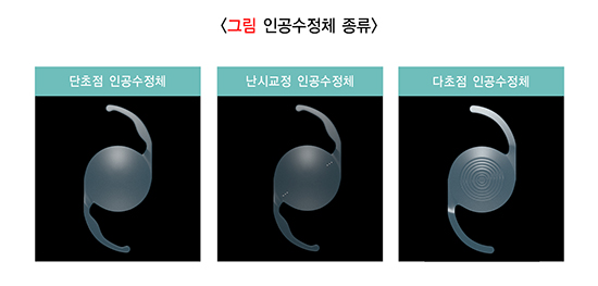 백내장 수술 비용, 백내장 검사 비용, 백내장 수술 시간, 백내장 수술 과정, 백내장 수술 잘하는 병원