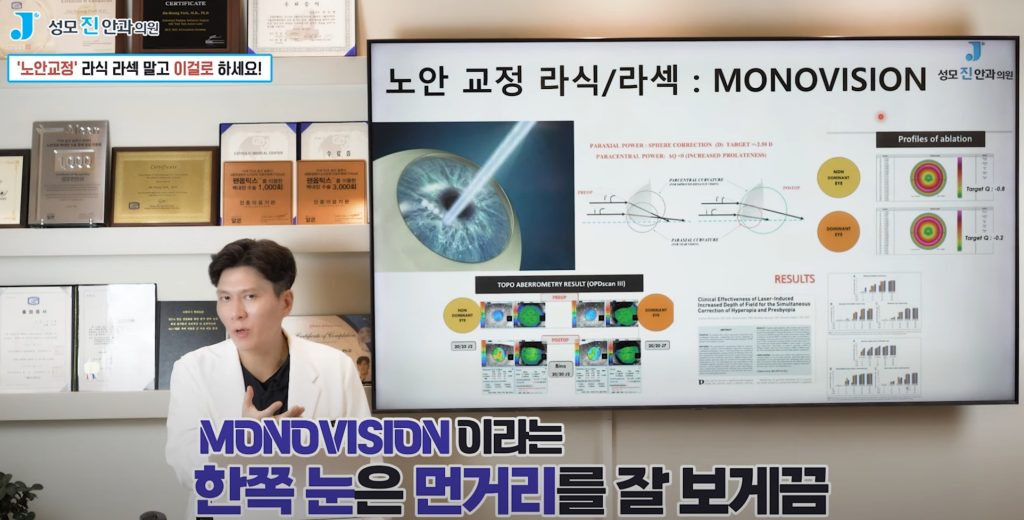 노안 치료, 노안 수술, 노안 증상, 노화 시작 나이, 모노비전
