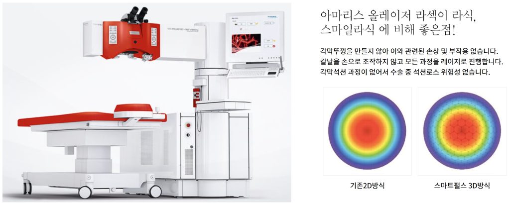  스마일 라식 vs 라섹, 스마일 라식 회복 기간, 스마일 라식 비용, 라섹 각막혼탁 증상, 라섹 시력회복 느린 이유