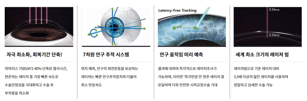 근시 퇴행, 고도 근시 스마일 라식, 스마일 라식 안되는 눈, 라섹 재수술, 각막강화술