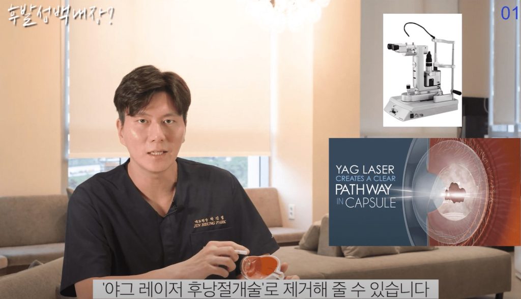  백내장 재수술, 백내장 수술 후 시력, 백내장 수술 후 부작용, 백내장 치료, 후발성 백내장