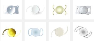 ICL 렌즈 부작용, 렌즈삽입술 후기, 각막 내피 세포, 렌즈삽입술 부작용, 렌즈삽입술 가격