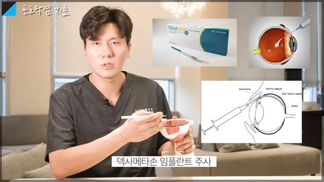 포도막염 증상, 포도막염 완치, 포도막염 실명, 포도막염 시력 회복, 포도막염 원인