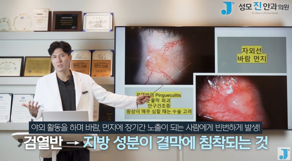 익상편, 검열반, 군날개, 눈 흰자 노란색, 눈에 이물감