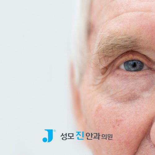 백내장 원인 5가지, 결국 답은 수술일까?