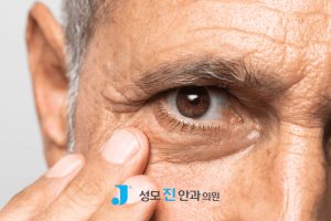 백내장 렌즈, 백내장 다초점 렌즈 부작용, 백내장 수술 방법, 다초점 렌즈 원리, 오디세이 렌즈