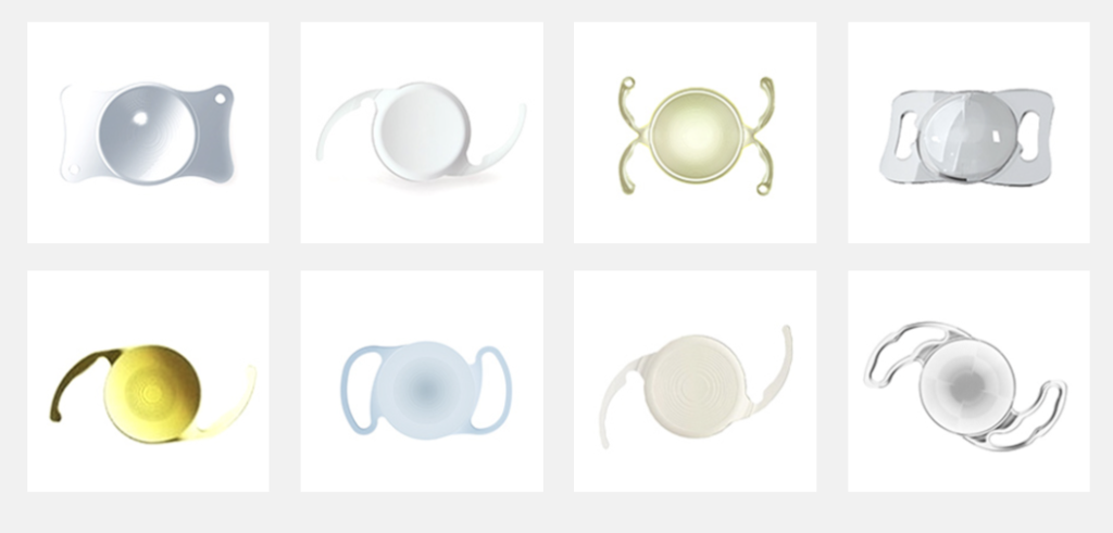 백내장 렌즈, 백내장 다초점 렌즈 부작용, 백내장 수술 방법, 다초점 렌즈 원리, 오디세이 렌즈