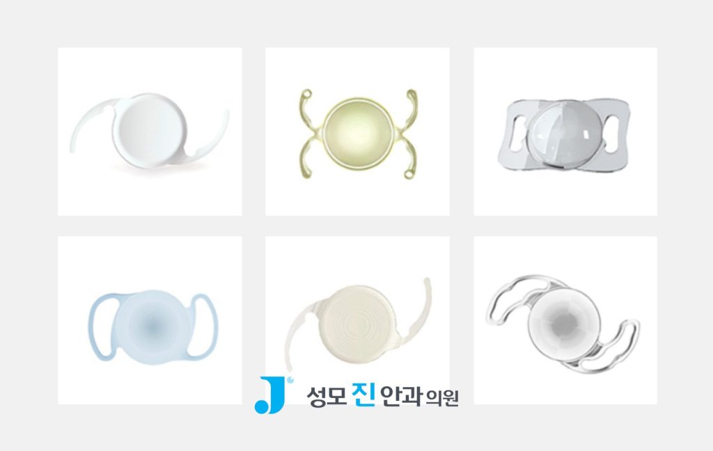 백내장 수술 방법, 모노비전, 믹스앤매치, 단초점렌즈, 다초점렌즈 종류