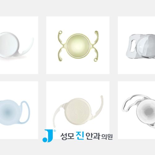 모노비전? 믹스앤매치? 백내장 수술 방법 2가지 알아보기