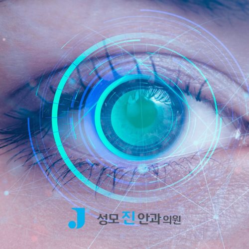 스마일 라식 안 되는 눈 유형 4가지, 대안 시력교정술은?