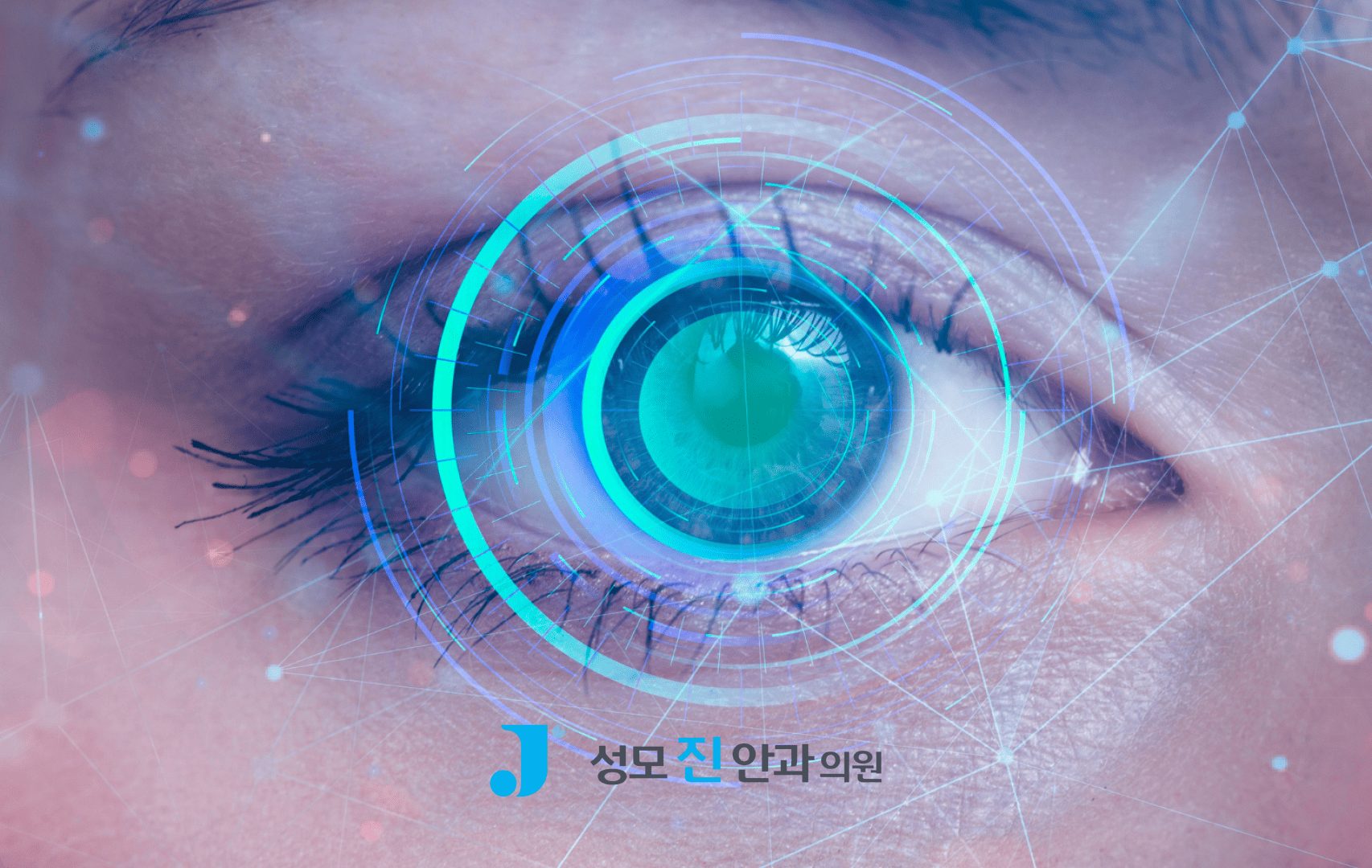 스마일 라식 안 되는 눈 유형 4가지, 대안 시력교정술은?
