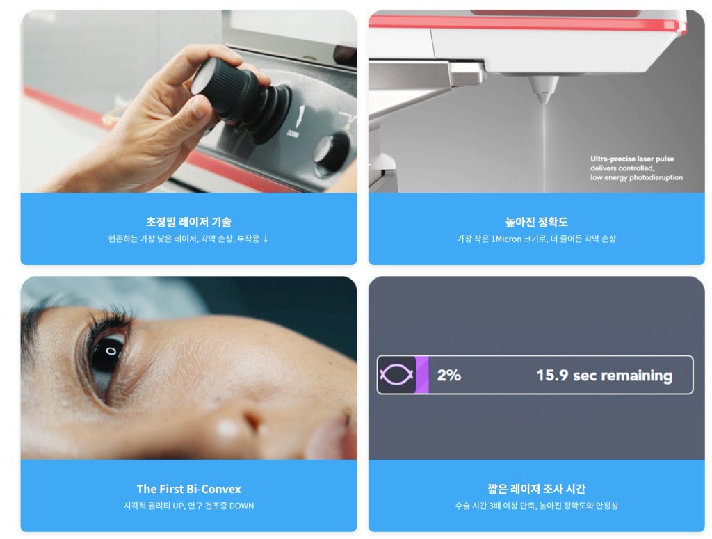 라식 종류, 실크 스마일 라식, 고도 근시 라식, 스마일 라식 라식 차이, 스마일 라식 시력 회복