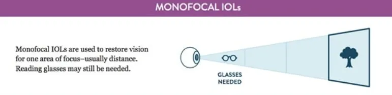 백내장 렌즈, 백내장 다초점 렌즈 부작용, 백내장 수술 방법, 다초점 렌즈 원리, 오디세이 렌즈