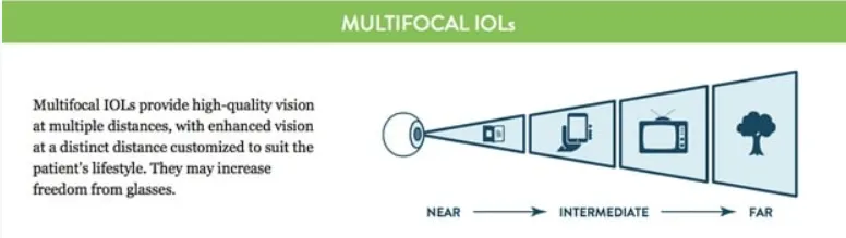 백내장 렌즈, 백내장 다초점 렌즈 부작용, 백내장 수술 방법, 다초점 렌즈 원리, 오디세이 렌즈