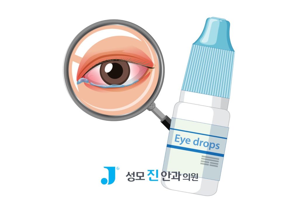 결막염 빨리 낫는 법, 결막염 증상, 결막염 전염, 결막염 걸리는 이유, 결막염 안약
