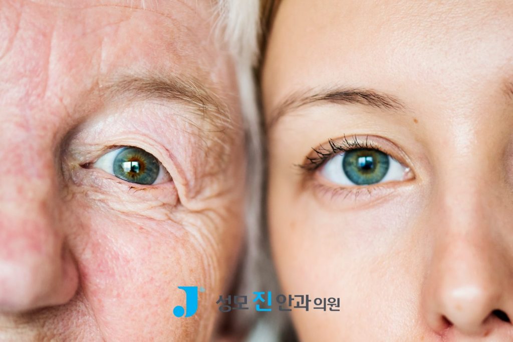 20대 백내장, 백내장 초기 증상, 백내장 원인, 백내장 치료, 백내장 수술 후 안경