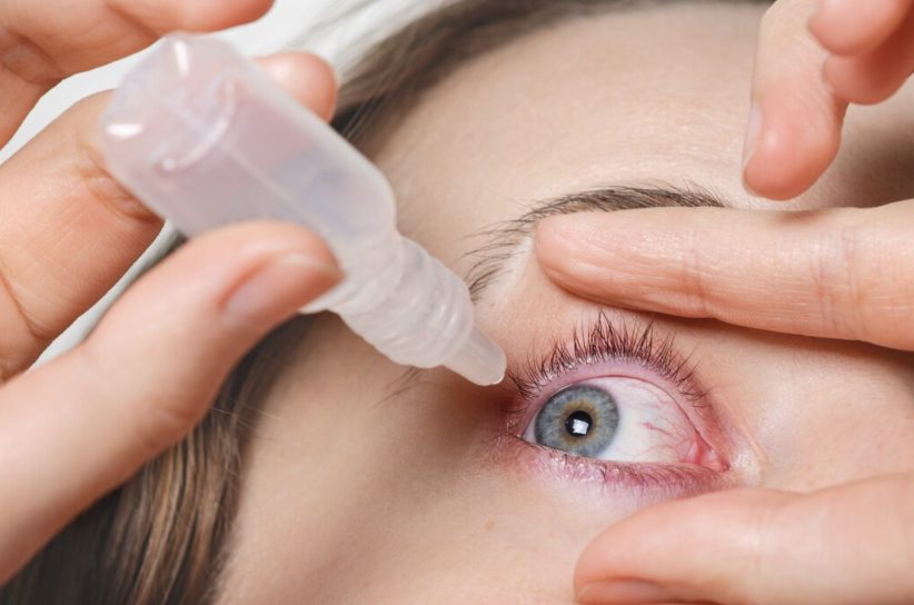 결막염 빨리 낫는 법, 결막염 증상, 결막염 전염, 결막염 걸리는 이유, 결막염 안약