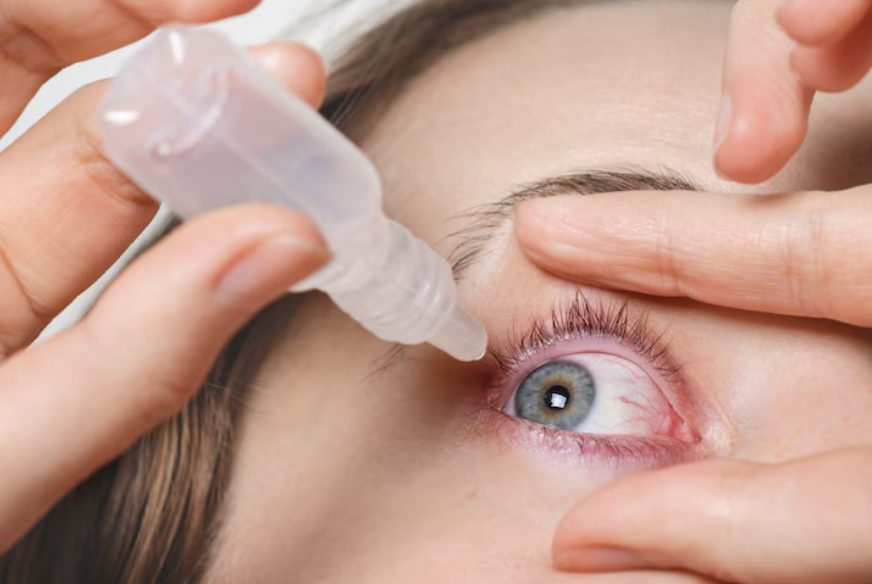 라섹 후 관리, 라섹 시력 회복, 라섹 보호 안경, 라섹 근시퇴행, 라섹 일주일 시력