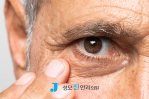 40대 백내장, 40대 노안, 40대 녹내장, 백내장 노안, 노안 오는 나이