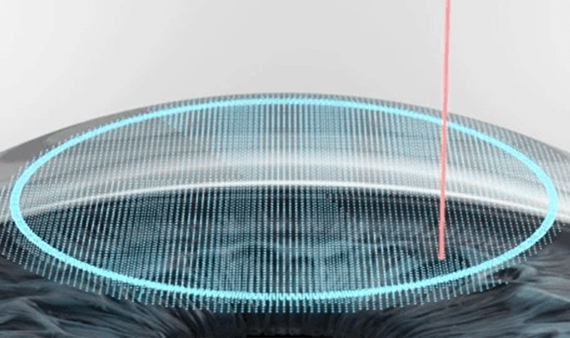 라식 후 컬러렌즈, 라식하고 컬러렌즈, 라식하면 렌즈, 라식 후 렌즈, 라식 후 안경