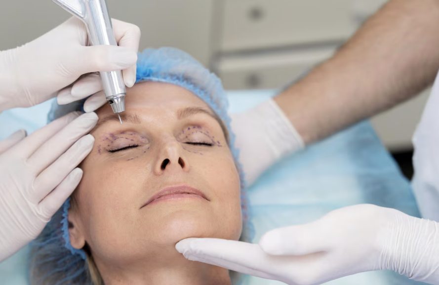 라식 쌍수, 쌍수 라식, 라식 상담, 라식 안압, 라식 시기