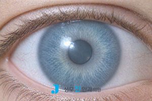 녹내장 눈동자, 녹내장 자가진단 각도, 녹내장에 안좋은 습관, 녹내장에 좋은 음식, 녹내장 영어로