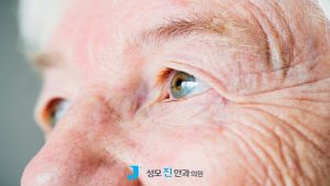 백내장 수술후 안경 맞추는 시기, 백내장 초기 사진, 노안 안경, 노안 뜻, 안약 유통기한
