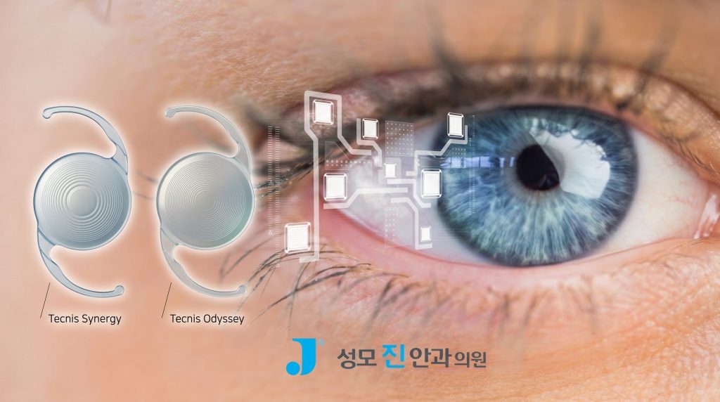 팬옵틱스 프로 vs 오디세이 렌즈, 노안 백내장 인공수정체 차이 비교