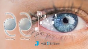팬옵틱스 프로 vs 오디세이 렌즈, 노안 백내장 인공수정체 차이 비교