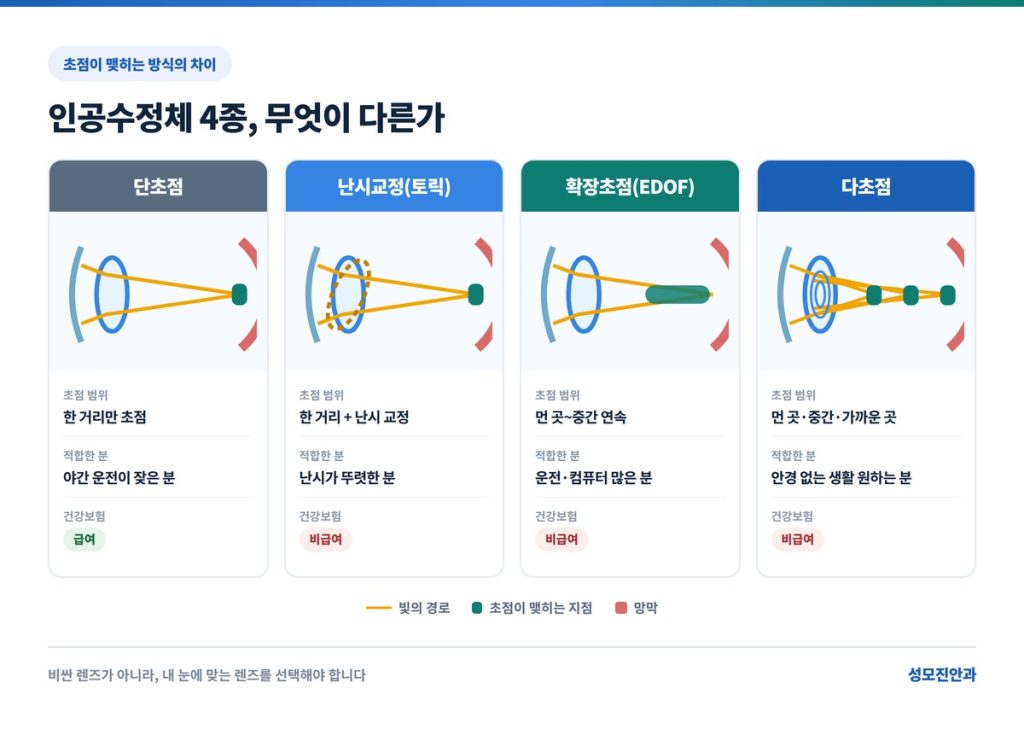 백내장 수술 시 인공수정체 종류별 차이점