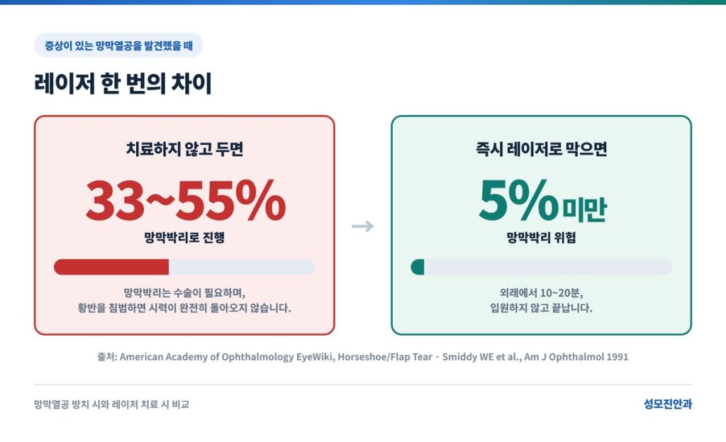비문증 치료로써 망막 열공이나 찢김 박리에 아르곤 레이저 광응고술 치료