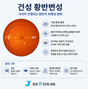 성모 진안과 건성 황반변성 드루젠 루테인